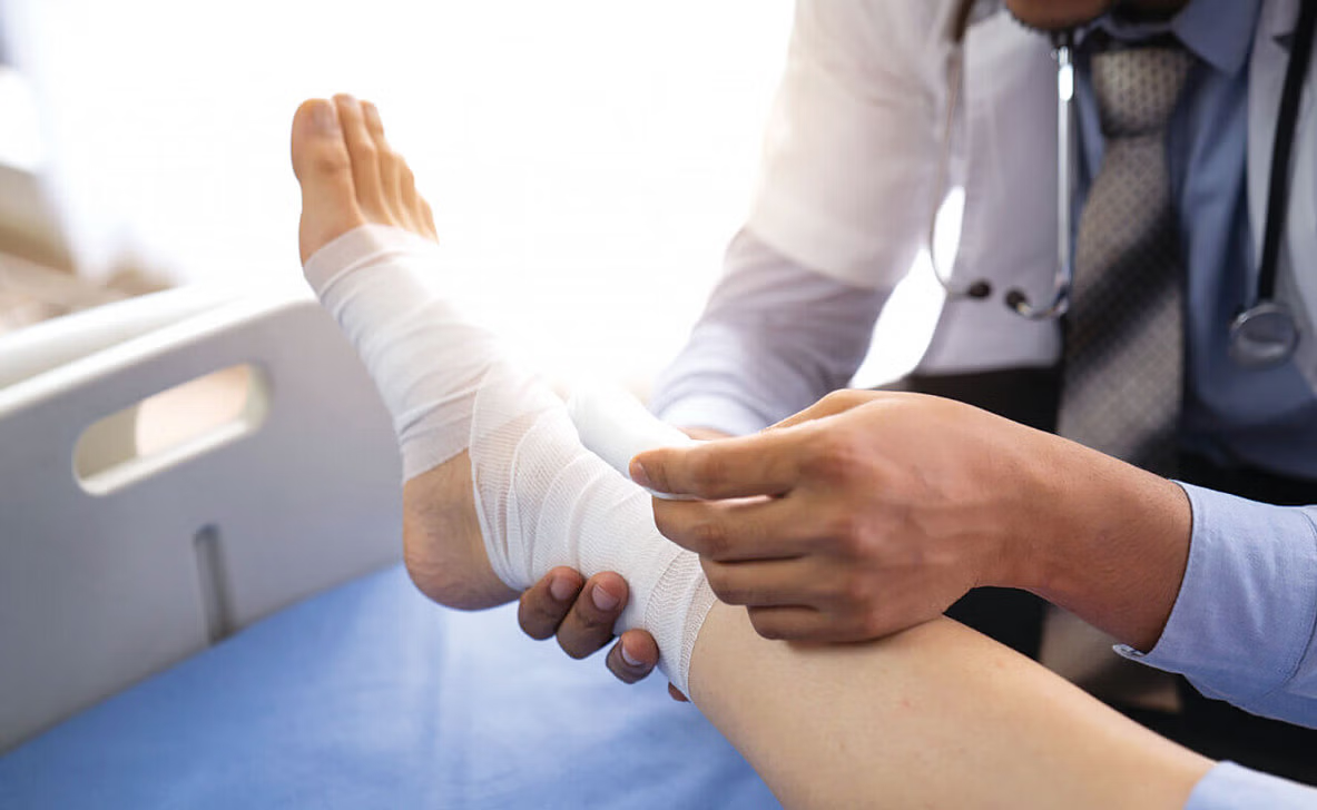 পা মচকানোর আধুনিক বিজ্ঞানসম্মত চিকিৎসা