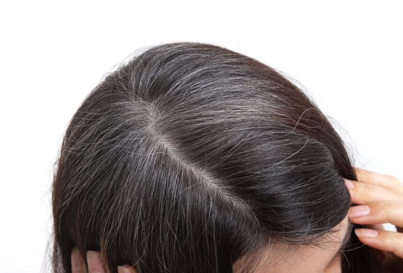 একটা পাকা চুল টেনে তুললে কি অনেকগুলো গজায়?