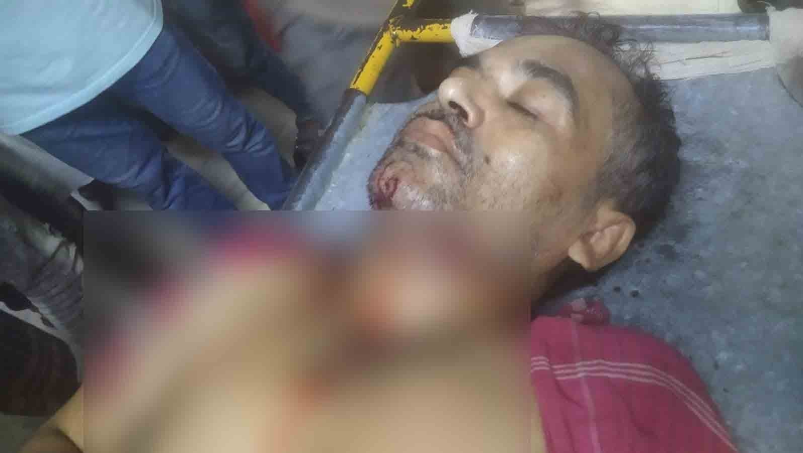 শনির আখড়ায় পুলিশের ছররা গুলিতে শিশুসহ আহত ৬