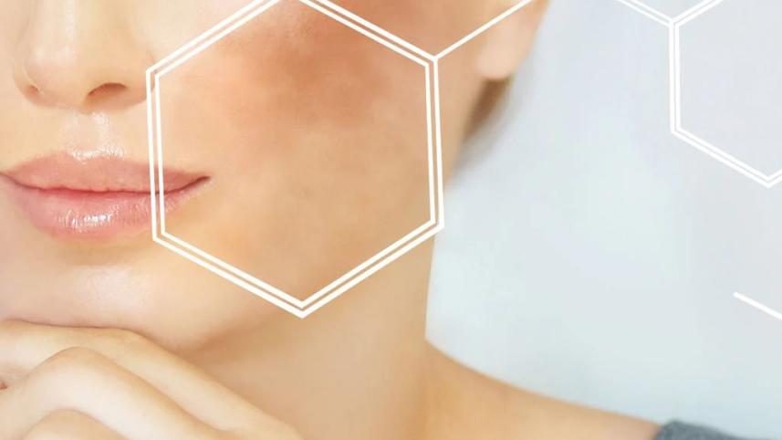 হাইপারপিগমেন্টেশন