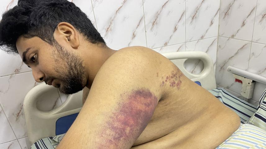 কোটা আন্দোলন