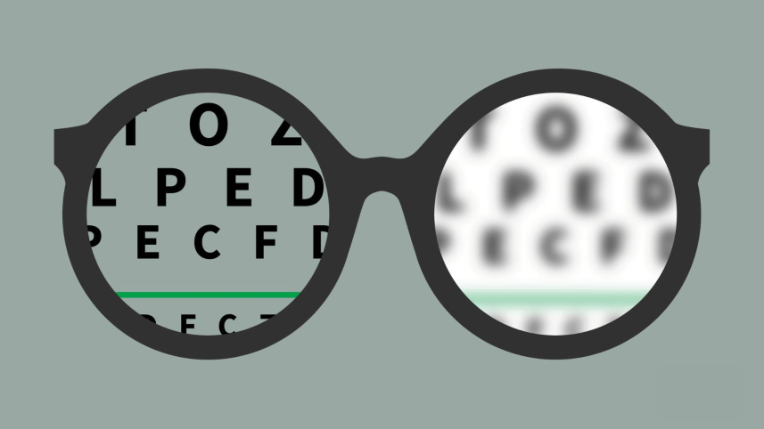 চোখের রোগ ‘মায়োপিয়া’ সম্পর্কে জানেন কি, আক্রান্ত হলে বুঝবেন যেভাবে