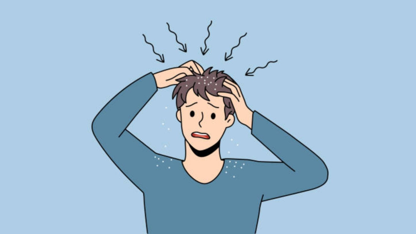 শীতে কি খুশকি বাড়ে