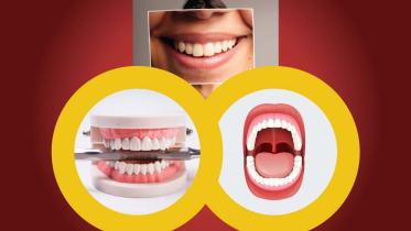 Oral disease photo collage collected (1).jpg