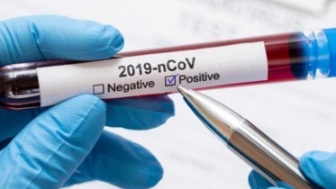 test_coronavirus-positive_0_0.jpg