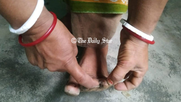 moulvibazar_waterburne_disease.jpg