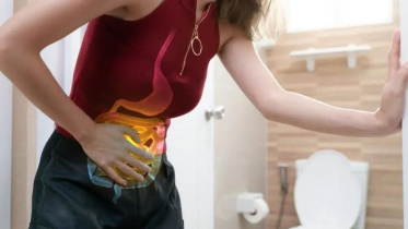 কোষ্ঠকাঠিন্য